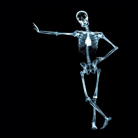 x rayed skeleton